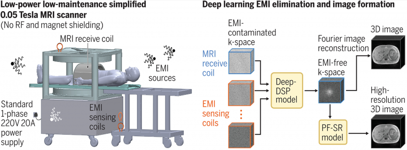 Prototype of a low-power, compact, and shielding-free MRI scanner using an open 0.05 Tesla permanent magnet. It incorporates active sensing and deep learning to address electromagnetic interference (EMI) signals.
 